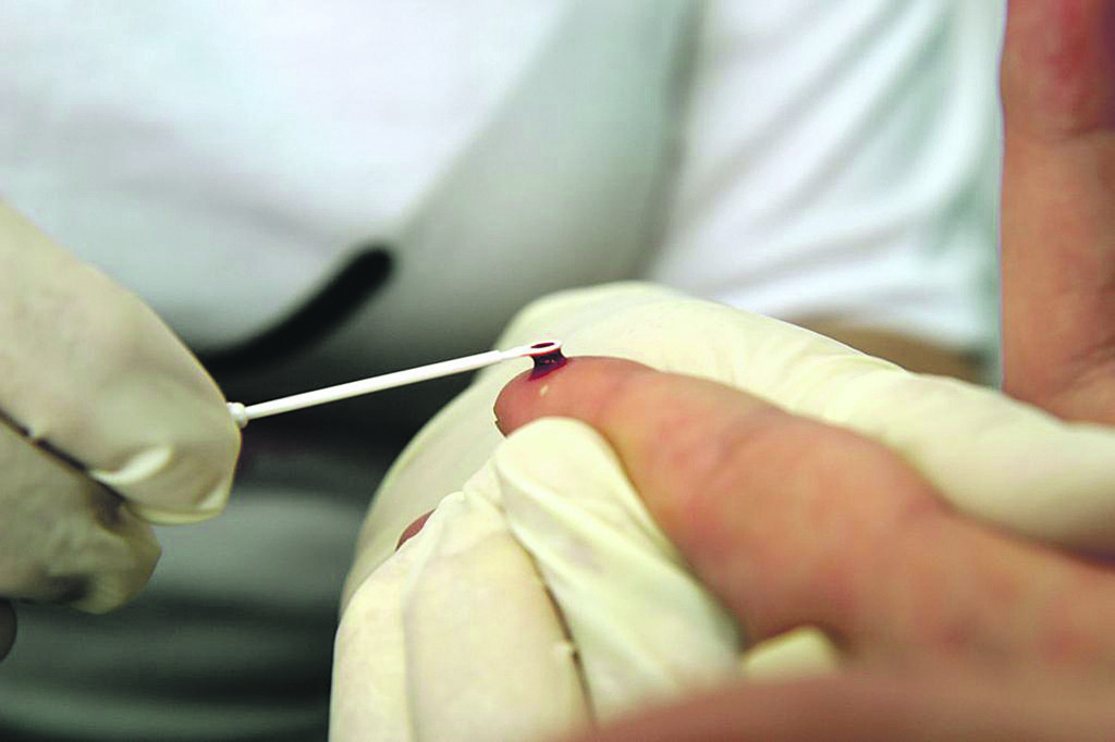 Brasil já conta com kit para autoteste para a detecção do HIV